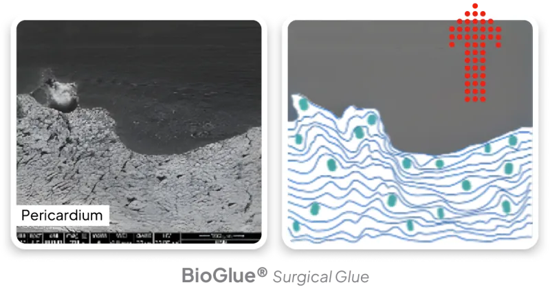 Diagram of current adhesives - superficial adhesion