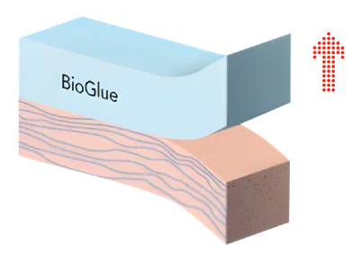 Comparison of current adhesives