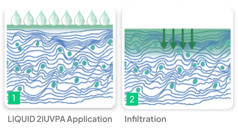 Scientific diagram of AnCor Technology adhesion